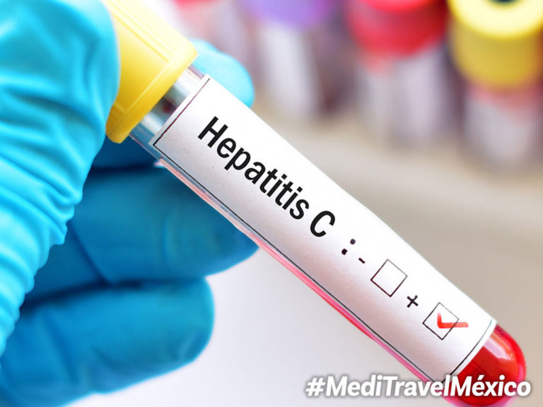 Continúa Diagnóstico Gratuito De Hepatitis C En Tijuana